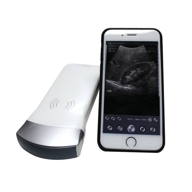 mobile ultrasound business contracts