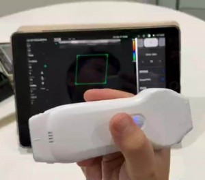 Single Head Phased Array Cardiology Wireless Color Doppler Ultrasound Probe uRason CW7