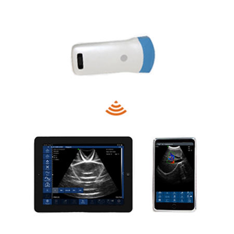 wireless ultrasound device