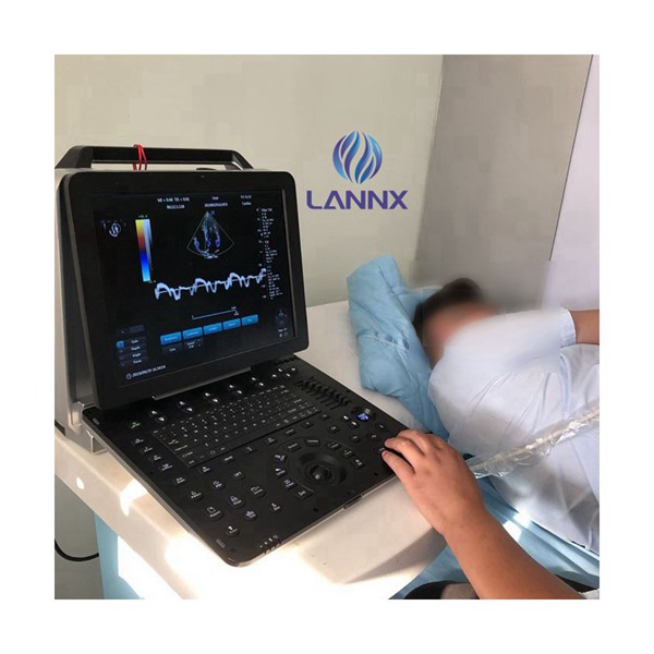 Best quality Healthcare Monitoring System - Portable robust cardiovascular ultrasound system with cardiac capability uDult P8  – Lannx