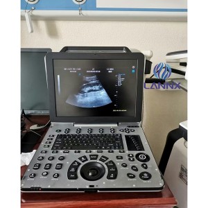 Sistim ultrasound cardiovascular kuat portabel kalawan kamampuhan cardiac uDult P8