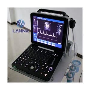 ລະບົບ ultrasound cardiovascular ທີ່ເຂັ້ມແຂງ Portable ທີ່ມີຄວາມສາມາດ cardiac uDult P8