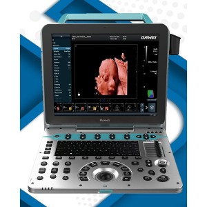 Usg 3D/4D/5D Portable koulè Doppler ultrason scanner uDult P5 PRO