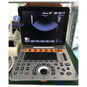 5d ultraschall awọ doppler aisan olutirasandi eto uDult P8 Lite