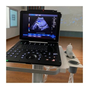 Przenośny kolorowy ultrasonograf dopplerowski USG 3D/4D/5D uDult P5 PRO