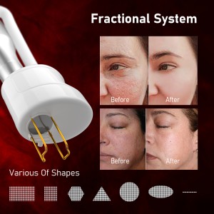 CO2 fractional laser machine scar removal vertical 980nm diode laser machine professional stretch mark removal