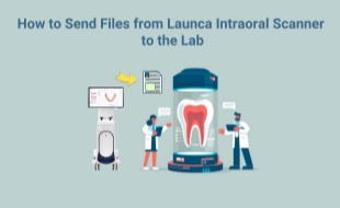 Launca 口腔内スキャナーから研究室にファイルを送信する方法