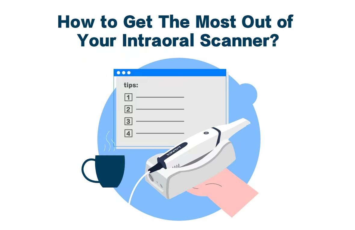 Sådan får du mest muligt ud af din intraorale scanner