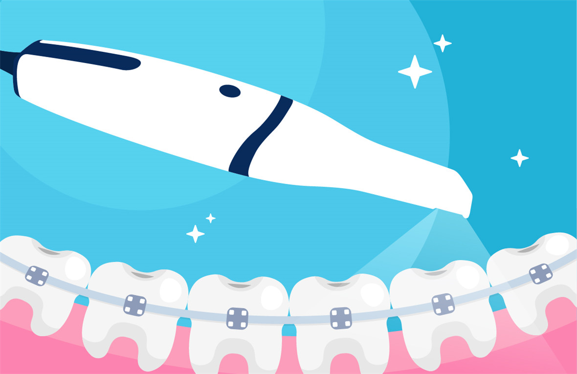 Амны хөндийн сканнерууд шүдний эмчилгээнд хэрхэн тусалдаг вэ?
