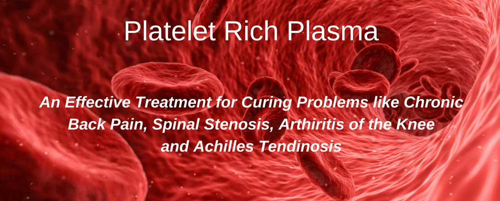Platelet Rich Plasma (PRP) Therapy: Cost, Side Effects and Treatment