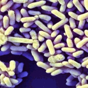 Bifidobacterium infantis 50 billion CFU/g