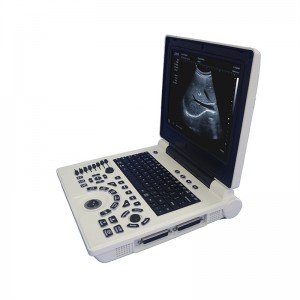 Medicinos ultragarso instrumentų nešiojamasis kompiuteris juodos spalvos ultragarso mašinų diagnostikos sistema