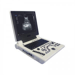 Fitaovana ara-pitsaboana Ultrasound Notebook B/W Ultrasonic Machine Diagnostic System