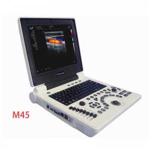 Enstriman ultrason 2D 3D 4D doppler eko pòtab Laptop dijital 12inch koulè pòtab machin medikal