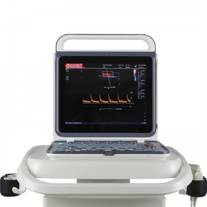 Scaner cu ultrasunete portabil M60 Echipament medical standard cu statie de lucru