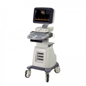 SM S60 超音波スキャナ 3D 4D カラードップラートロリー 超音波検査診断システム