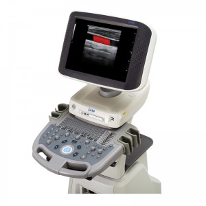 SM S60 अल्ट्रासोनिक स्कॅनर 3D 4D कलर डॉपलर ट्रॉली सोनोग्राफी निदान प्रणाली