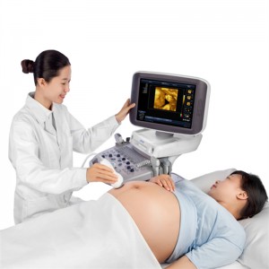 SM S60 Ultrasonic Scanner 3D 4D Faarfdoppler Trolley Sonography Diagnosesystem