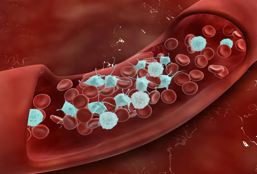 What are the 5 warning signs of a blood clot?