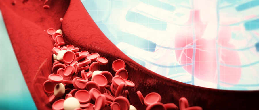 Kaip efektyviai sumažinti lipidų kiekį kraujyje?