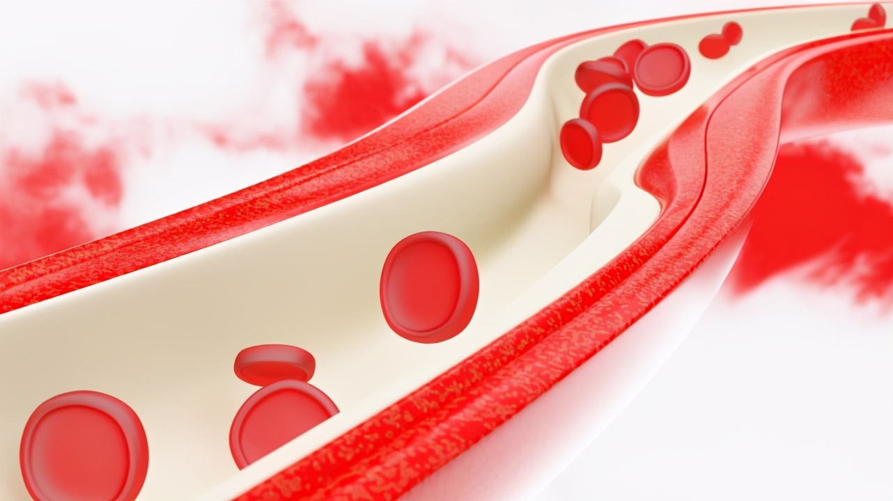 Die postoperative Blutungssterblichkeit übersteigt die postoperative Thrombose
