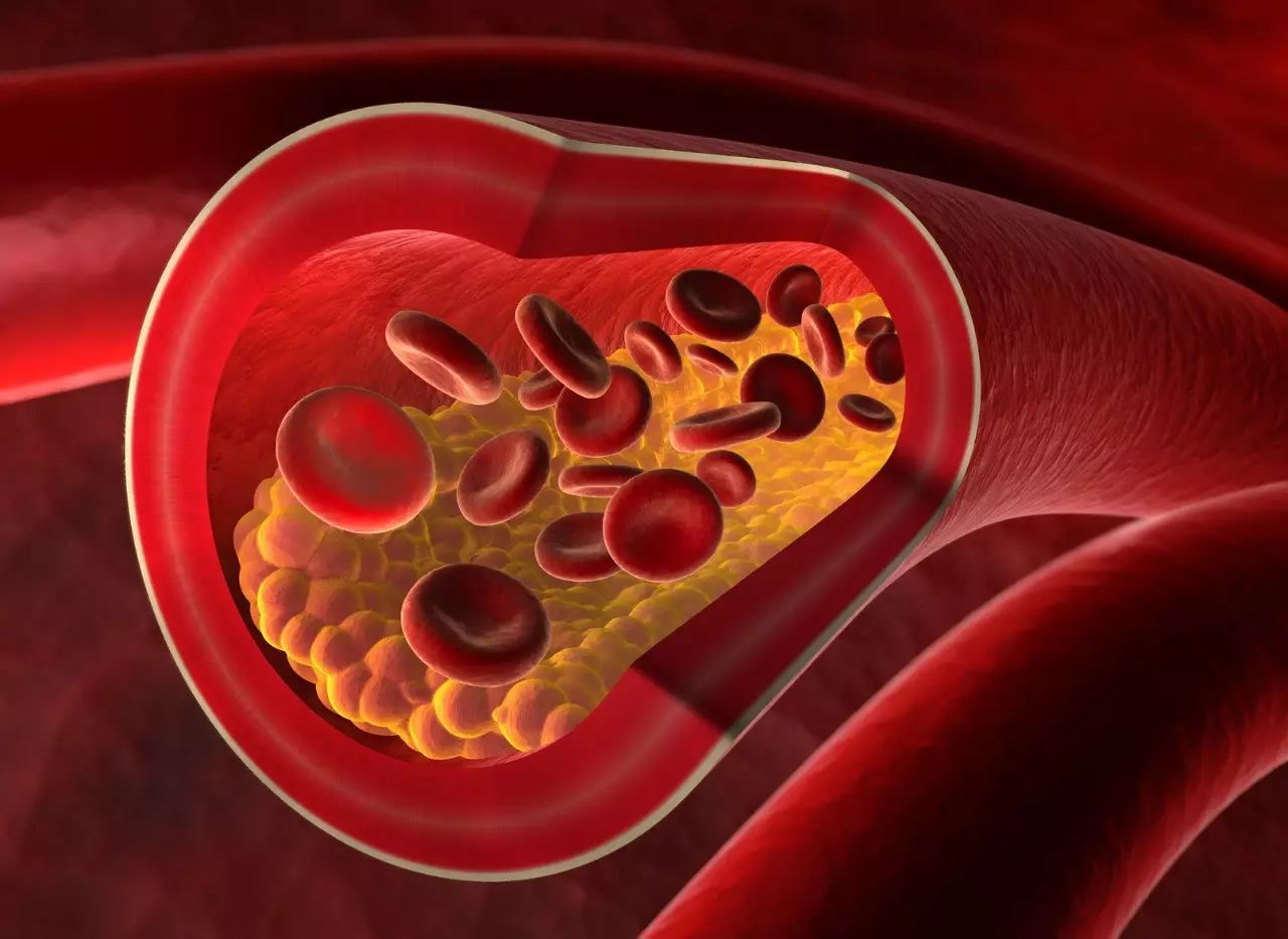 What Is The Best Treatment For Thrombosis?