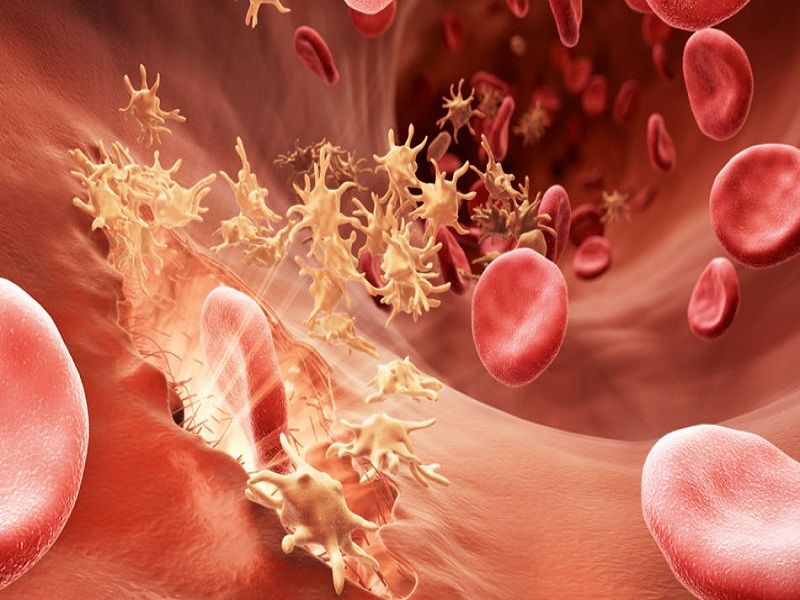 Achten Sie auf den Thromboseprozess