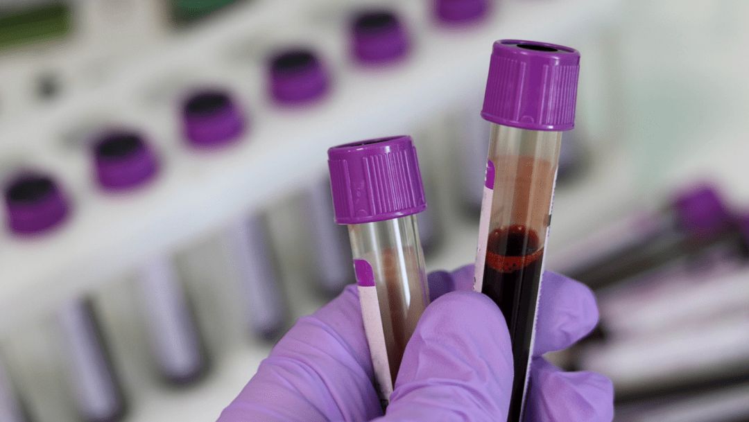 Testovi koagulacije krvi za APTT i PT reagens