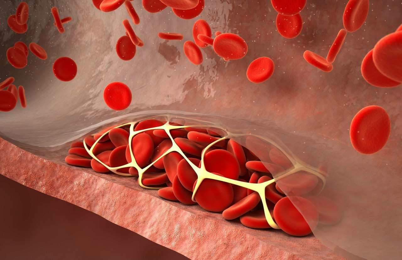 What diseases can subcutaneous hemorrhage be related to? Part One