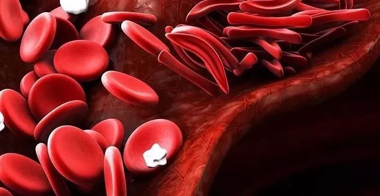 Come prevenire la coagulazione del sangue？