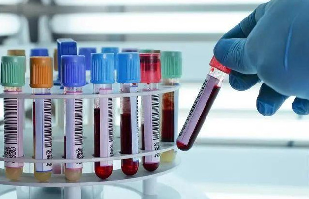 What blood tests are done for bleeding disorders?