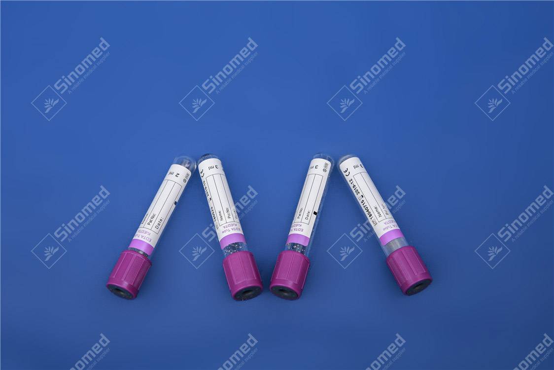 edta k2 tube for blood collection Edta And Gel Tube Featured Image