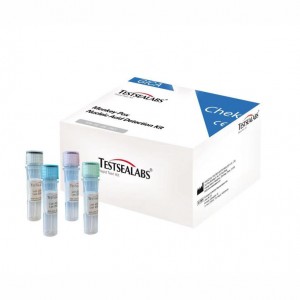 Monkeypox Virus (MPV) Nucleic Acid Detection Kit