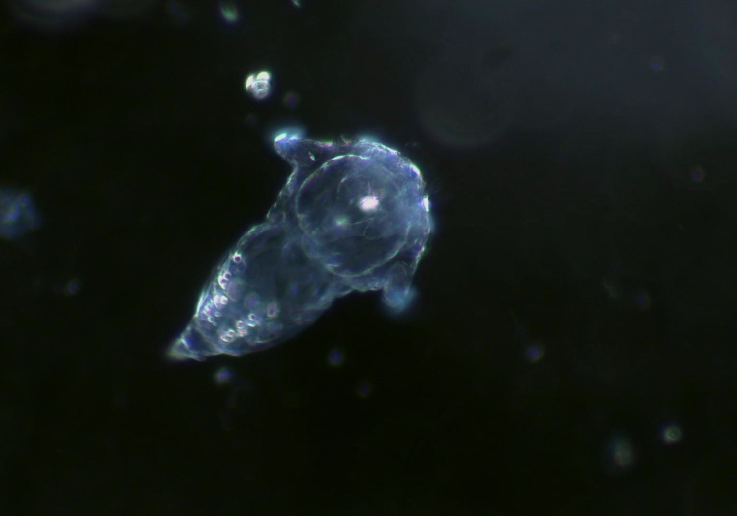 Plankton dark-field video taken by TrueChrome II