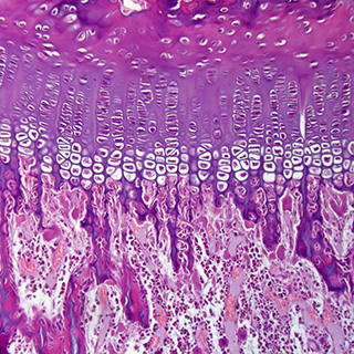 Microscopaidh bith-eòlasach-Plàta epiphyseal