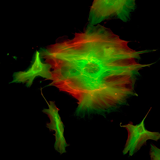 Fluorescence microscopy - Dandelion fluff