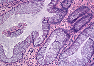 Pathological analysis – Biology Microscopy