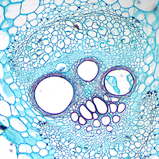 Biological microscopy-pumpkin stem