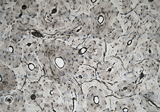 Bone Marrow Section Bright Field  Microscopy imaging