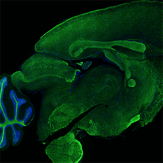 Brain Tissue Fluorescence Imaging