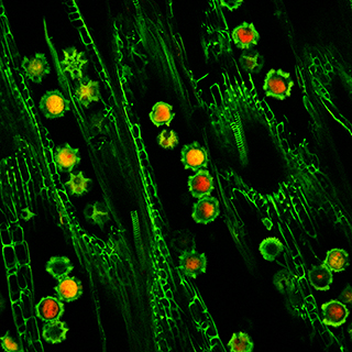 Fluorescence microscopy - cells