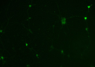 Neuronal fluorescence imaging