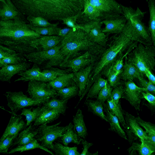 Bone Cells Fluorescence Imaging