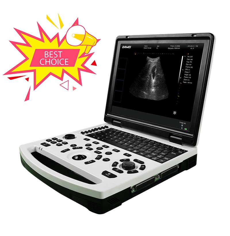 Siostam ultrasound dubh is geal laptop saor DW-690 Ìomhaigh Sònraichte