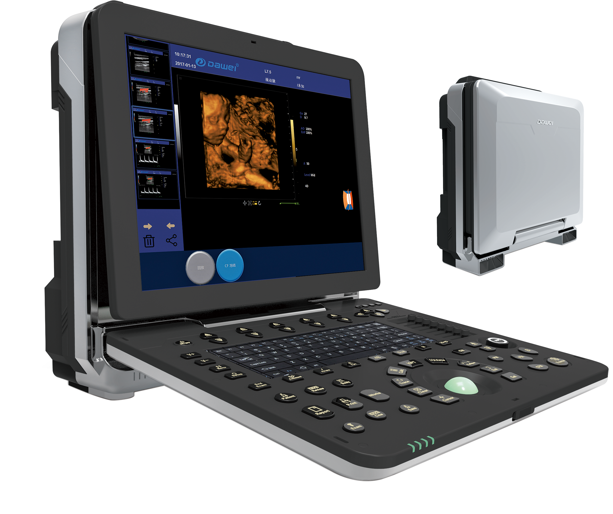 DW-P8—Portable Ultrasound na nakatuon sa Women's Health