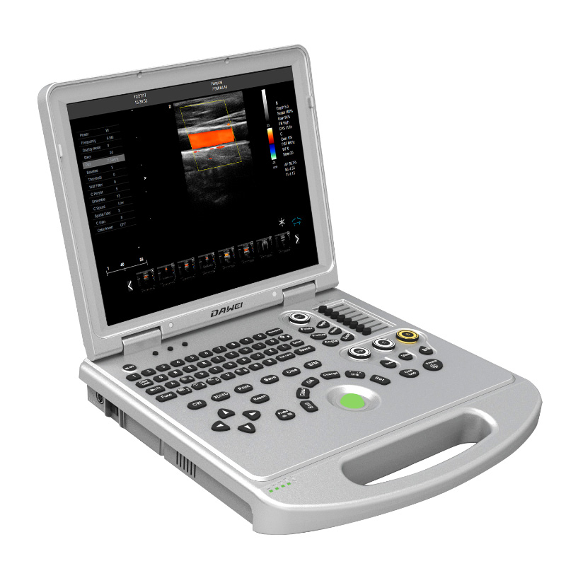 L5 economical type laptop 3d4d color doppler ultrasound baby scan