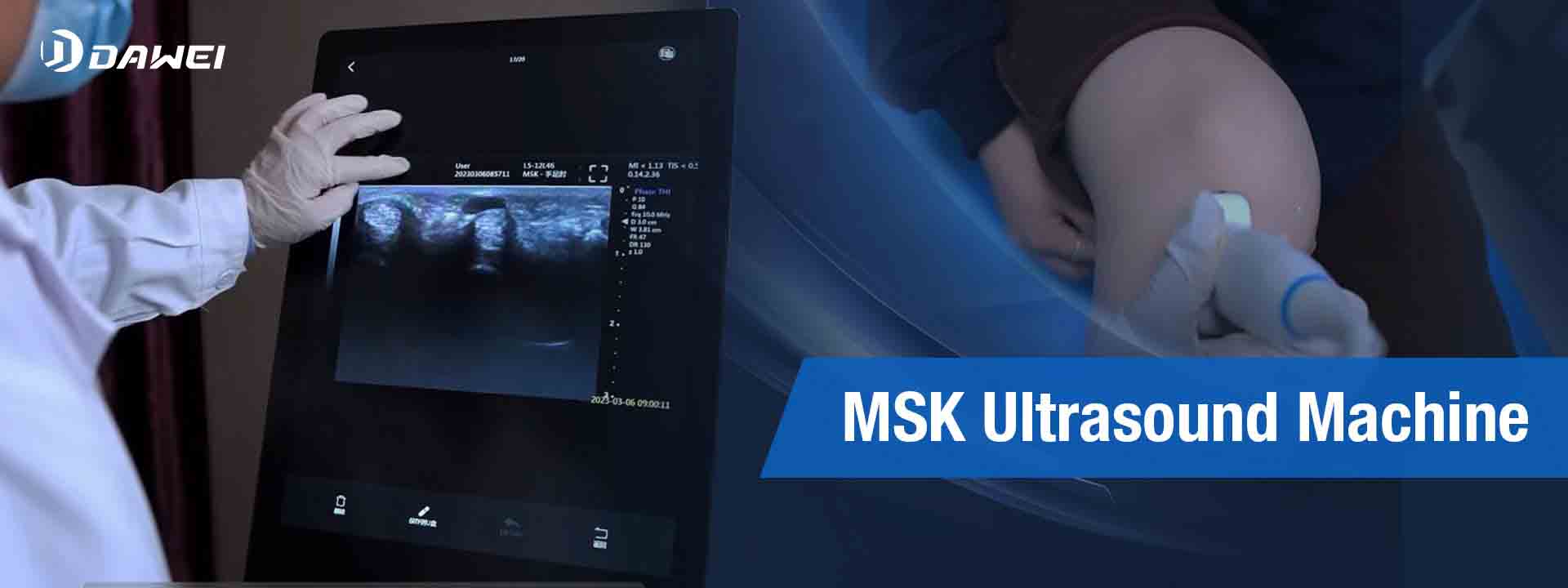 Inneal Ultrasound MSK airson a reic