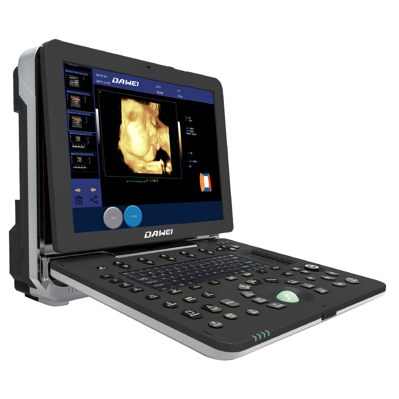 Aparat de scanare cu ultrasunete DW-P6(PF580) color doppler baby 4d Imagine prezentată