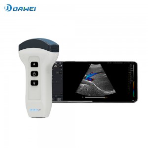 Wireless Handheld Ultrasound Scanner