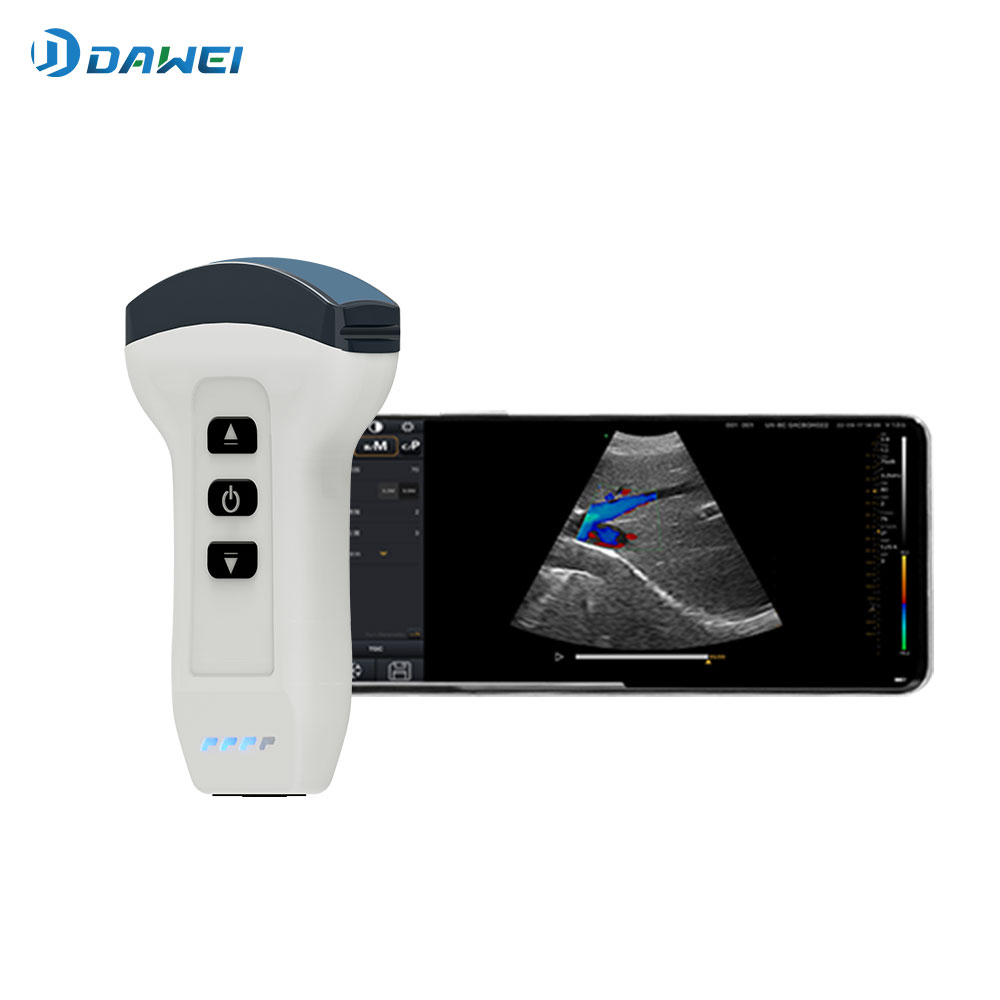 Immagine in evidenza dello scanner a ultrasuoni portatile wireless